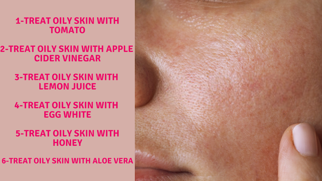 Oily Skin - 06 Easy Home Remedies For Oily Skin