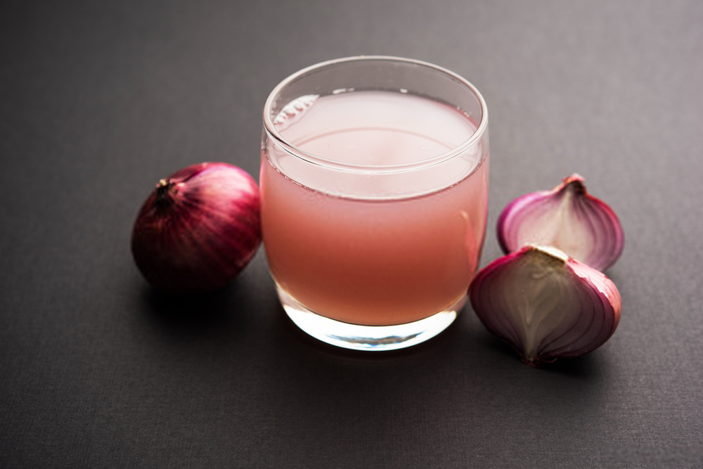 Onion Juice For Head Lice Treatment