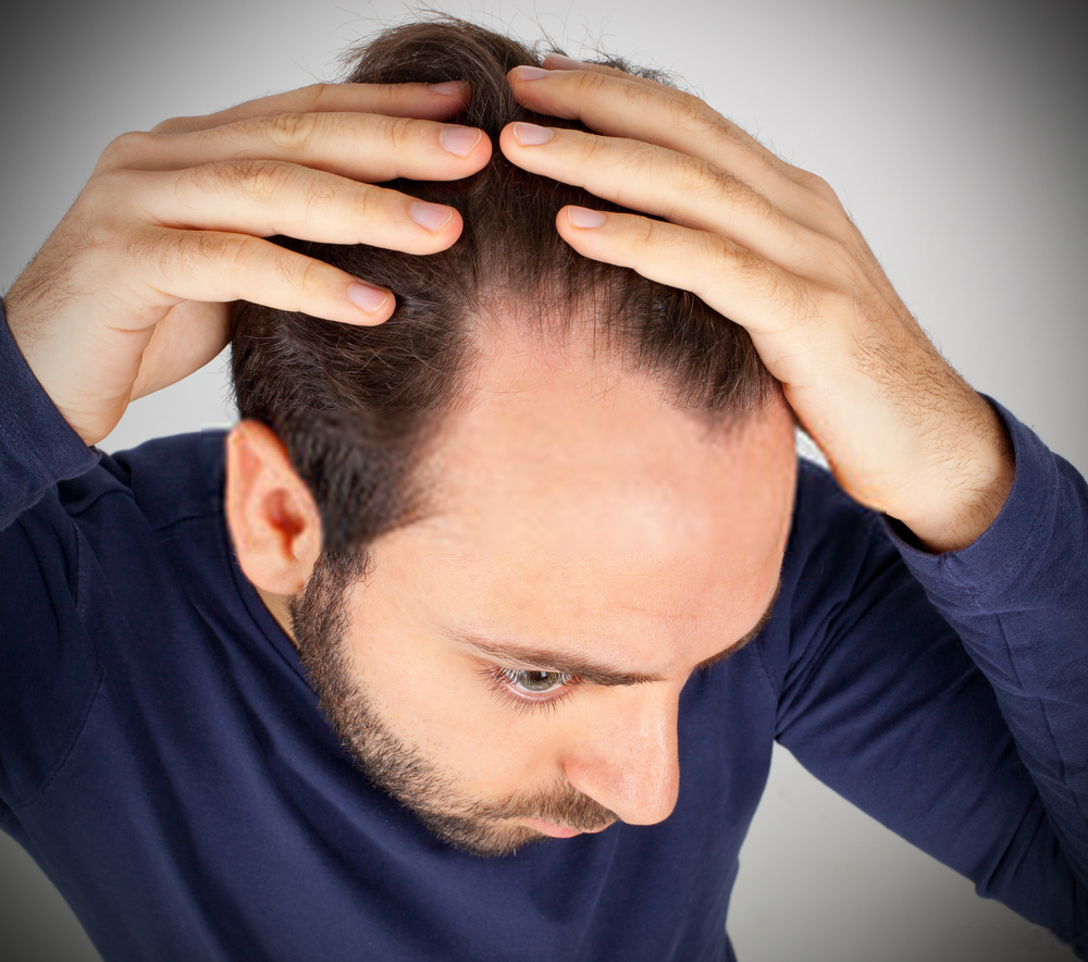 Hair Loss Causes in Young Males