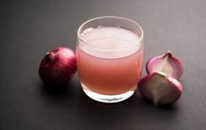 Blackheads Removal At Home With Onion Juice