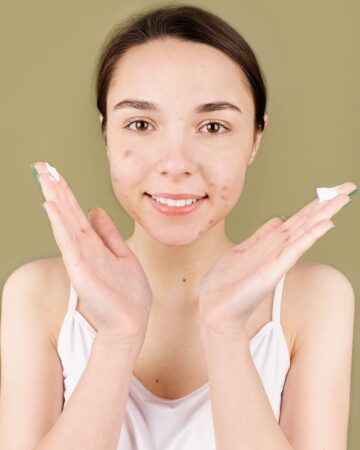 Effective Acne Skin Care Routine