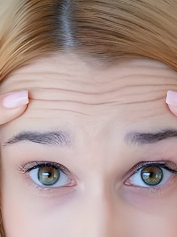Forehead Wrinkles Treatment